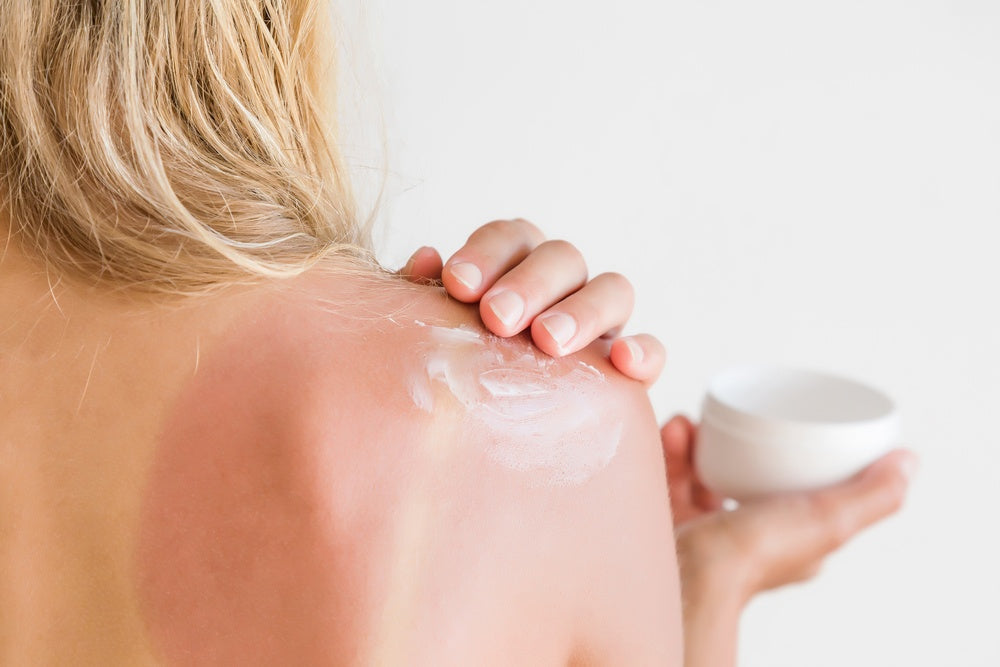 This Is What REALLY Happens to Your Skin When You Get a Sunburn